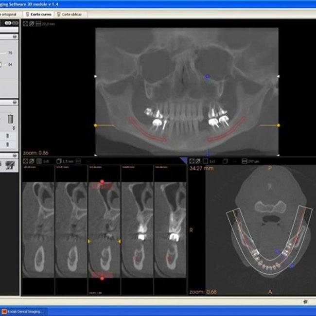 Vídeo tutorial KDIS | Imagen Diagnóstica Dental Dr. Mayor