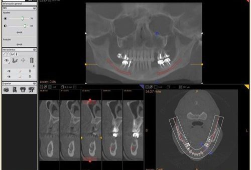 Vídeo tutorial KDIS | Imagen Diagnóstica Dental Dr. Mayor