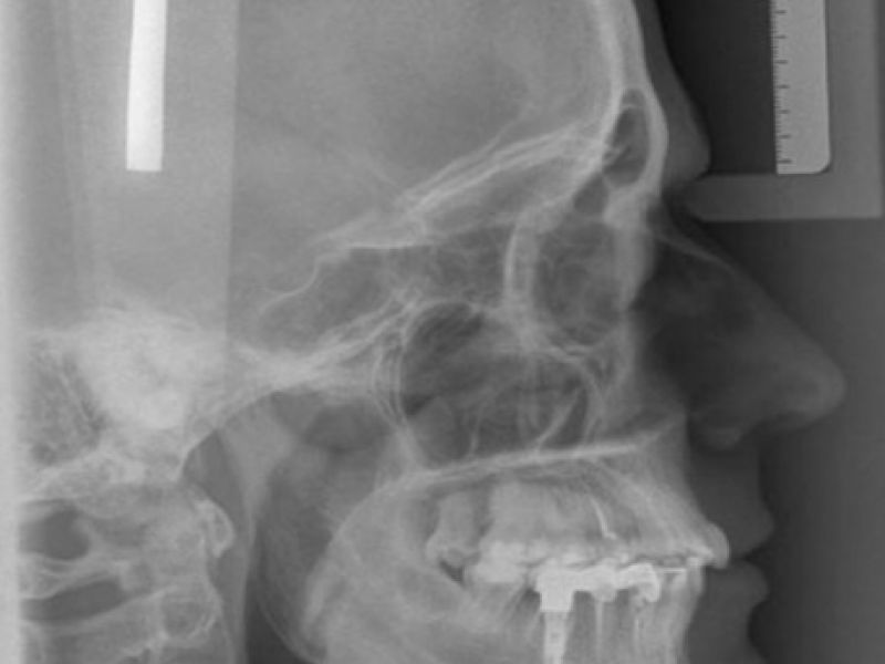 Telerradiografía Telerradiografía