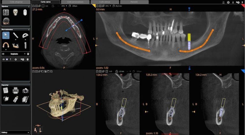 Clínica radiológica maxilofacial | Imagen Diagnóstica Dental Dr. Mayor