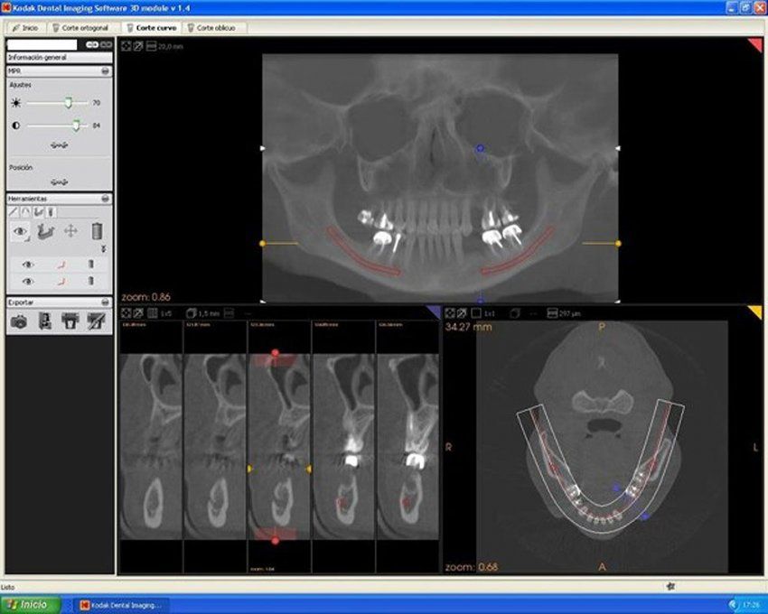 Vídeo tutorial KDIS | Imagen Diagnóstica Dental Dr. Mayor