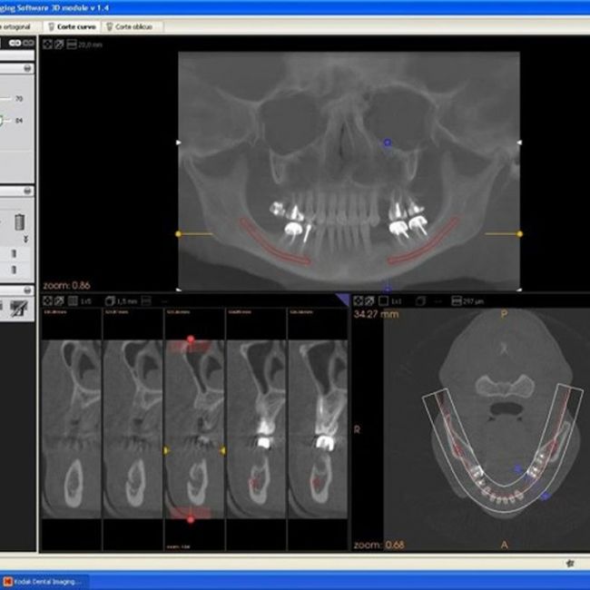 Vídeo tutorial KDIS | Imagen Diagnóstica Dental Dr. Mayor