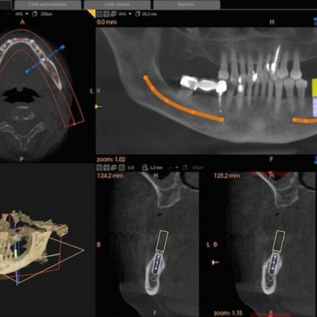 Clínica radiológica maxilofacial | Imagen Diagnóstica Dental Dr. Mayor