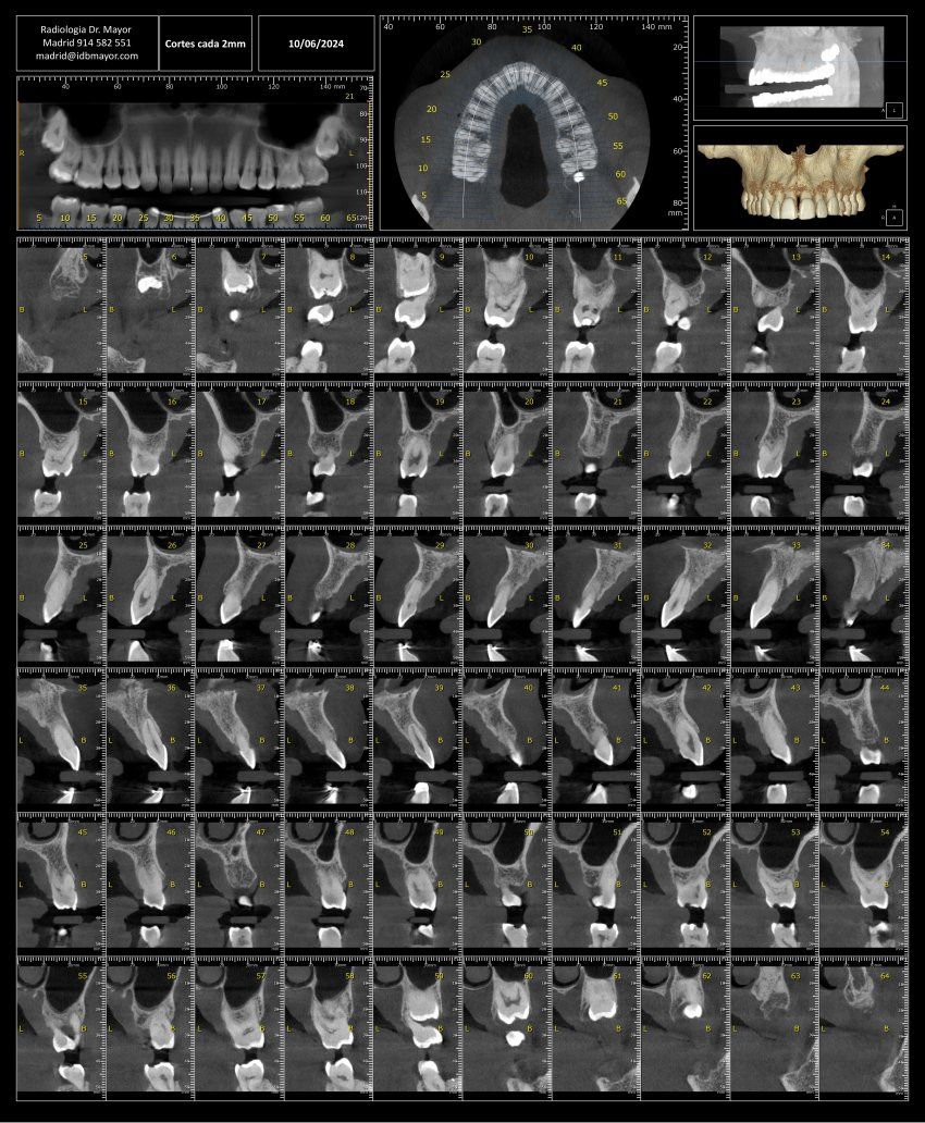 Centro 3D Radiodiagnóstico Madrid