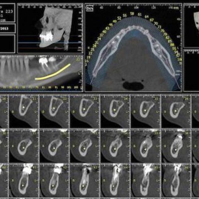 Dentascan 3D para mejorar el diagnóstico de los pacientes