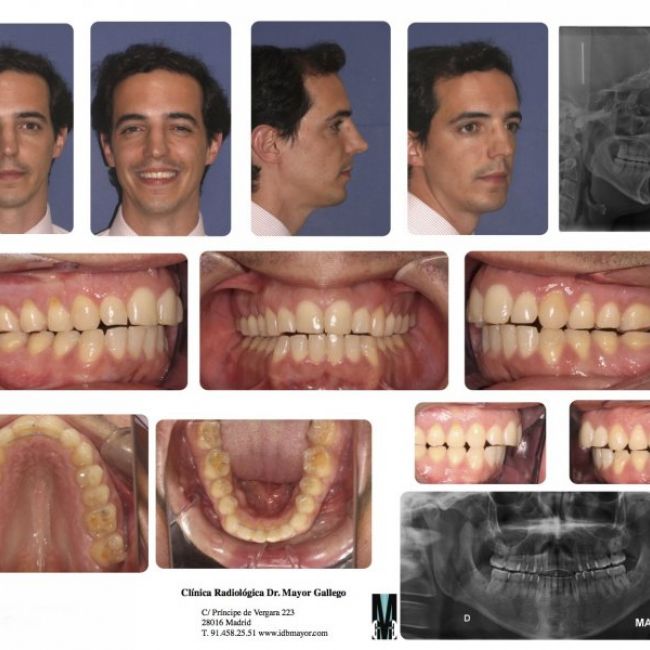 Fotografía de ortodoncia digital en Madrid | Imagen Diagnóstica Dental Dr. Mayor