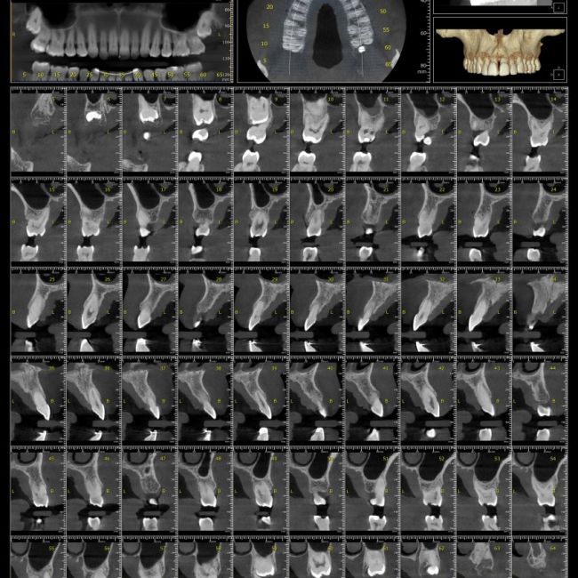 Centro 3D Radiodiagnóstico Madrid