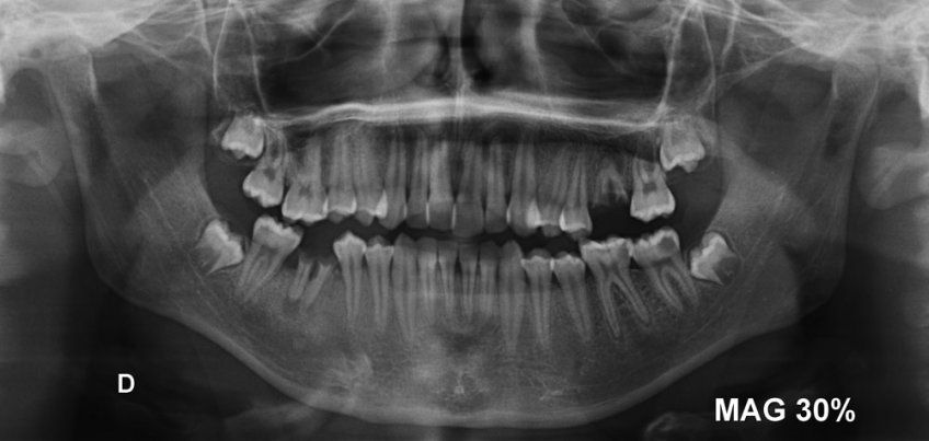 Estudio de ortodoncia en Madrid
